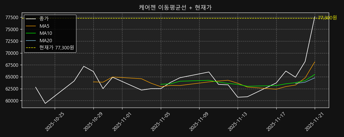 이동평균선 차트